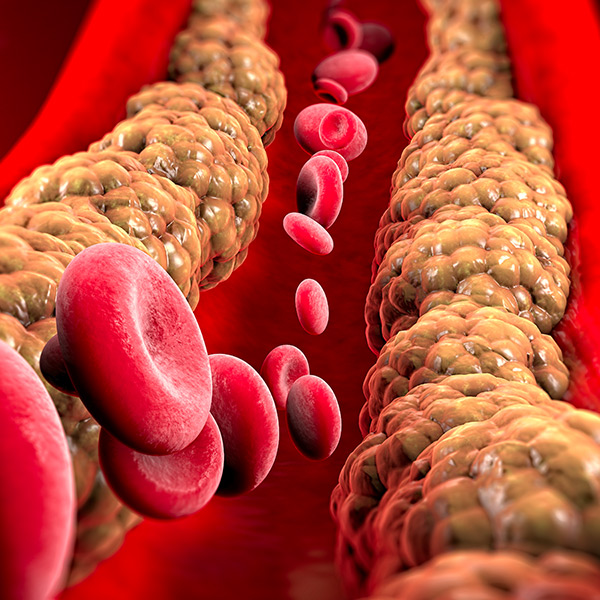 Good Cholesterol, Bad Cholesterol: What's The Difference?